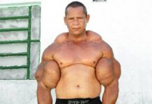 Murió “Popeye”, el fisicoculturista brasileño que se inyectaba aceite para tener unos bíceps de 73 centímetros