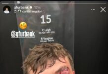 La impactante lesión de un jugador de rugby que quedó los dientes colgando: su particular reacción