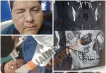 Un fracturado, gases, balas de goma y un DT argentino entre los 17 expulsados: el video de la batalla campal en Bolivia